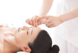 顔面への鍼施術